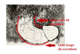 ressonância doença de peyronie