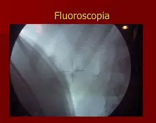 FLUOROSCOPIA