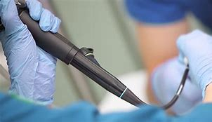 cistoscopio flexível