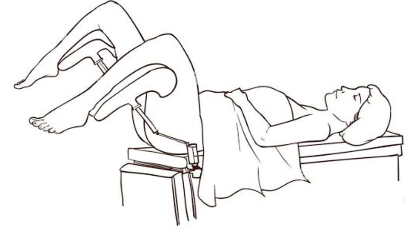 posição de litotomia para cistoscopia